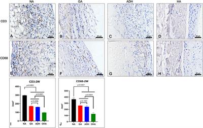 Free-aldehyde neutralized and oligohyaluronan loaded bovine pericardium with improved anti-calcification and endothelialization for bioprosthetic heart valves